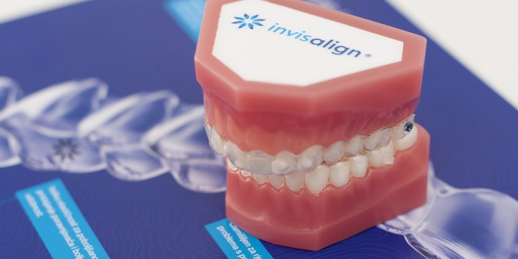 stomatološka ordinacija Čeović Invisalign ortodontska terapija