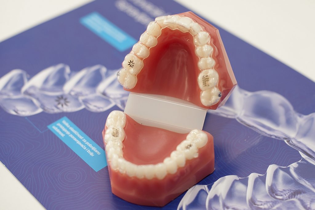 stomatološka ordinacija Čeović Invisalign ortodontska terapija 