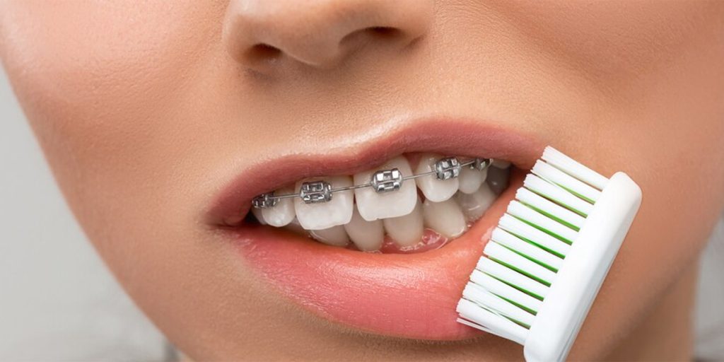 stomatološka ordinacija Čeović pranje zubi s aparatićem