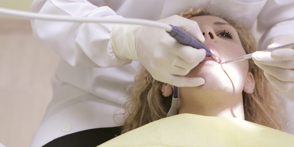 stomatološka ordinacija Čeović zubni kamenac