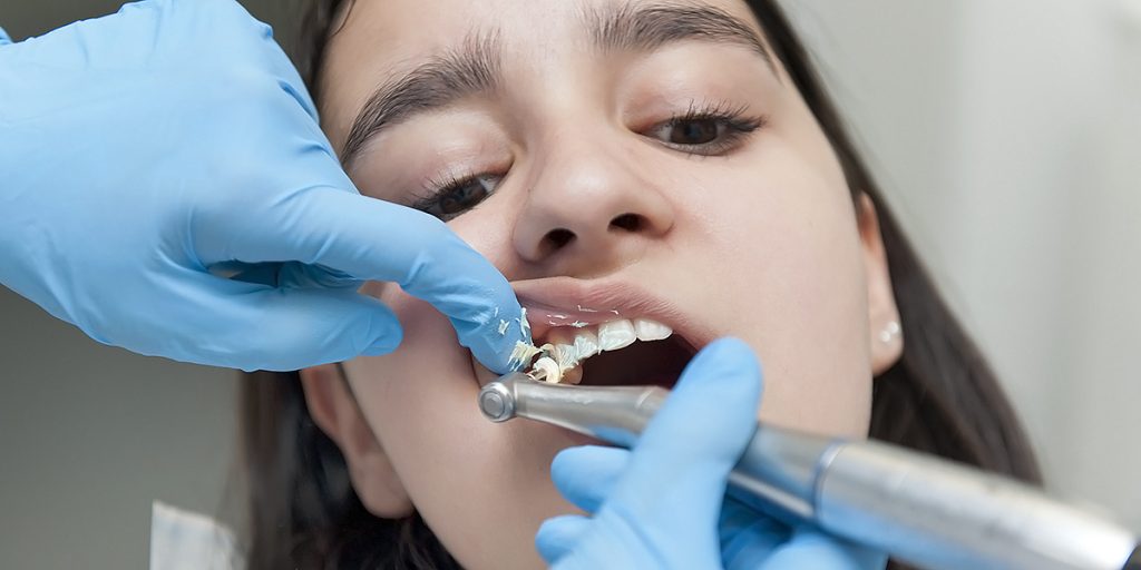 stomatološka ordinacija Čeović - zašto se djeca boje zubara