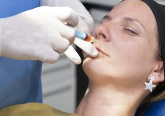 stomatološka ordinacija Čeović PRF tretman