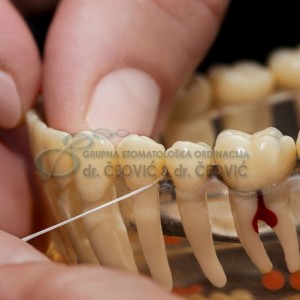 Upotreba zubnog konca